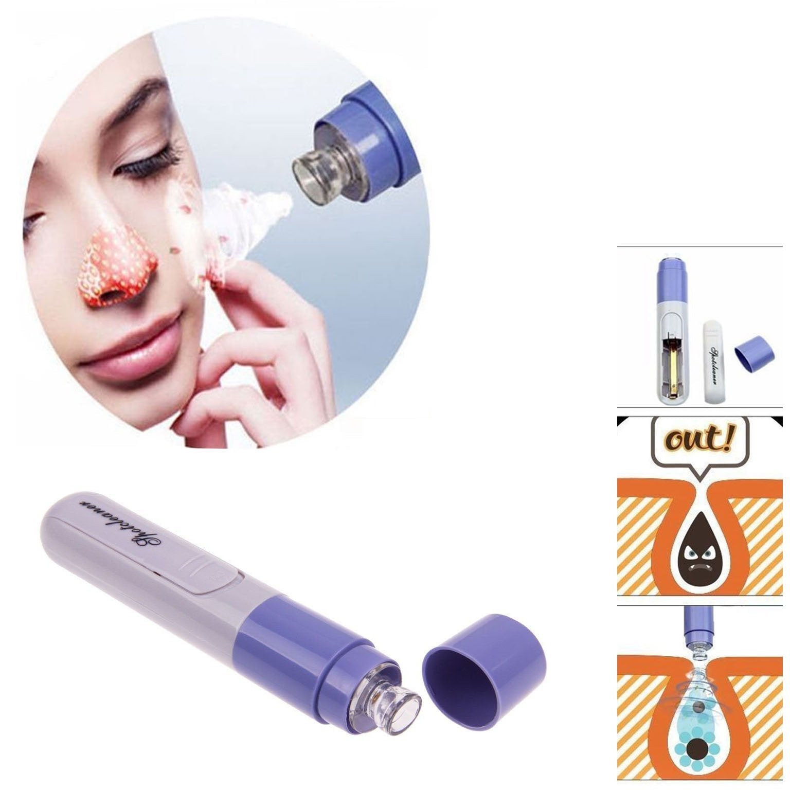 Electric Facial Pore Cleanser Skin Cleansing Tool