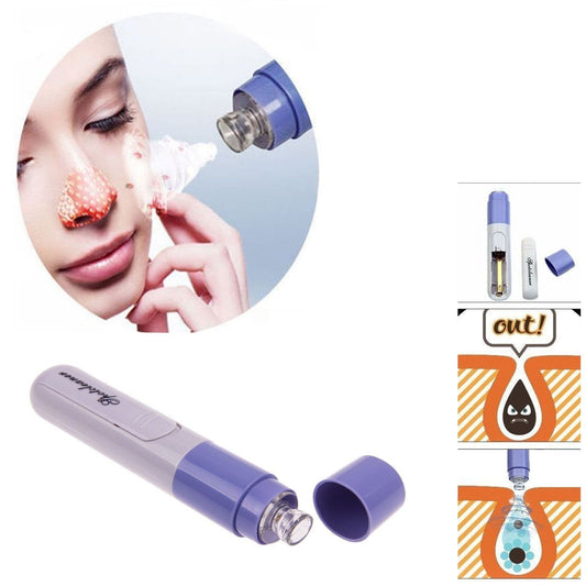 Electric Facial Pore Cleanser Skin Cleansing Tool